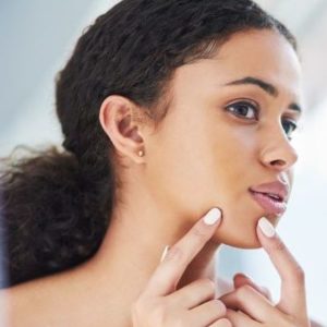 Best Pimples and Acne Treatment